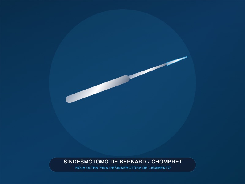 Sindesmótomo de Bernard / Chompret